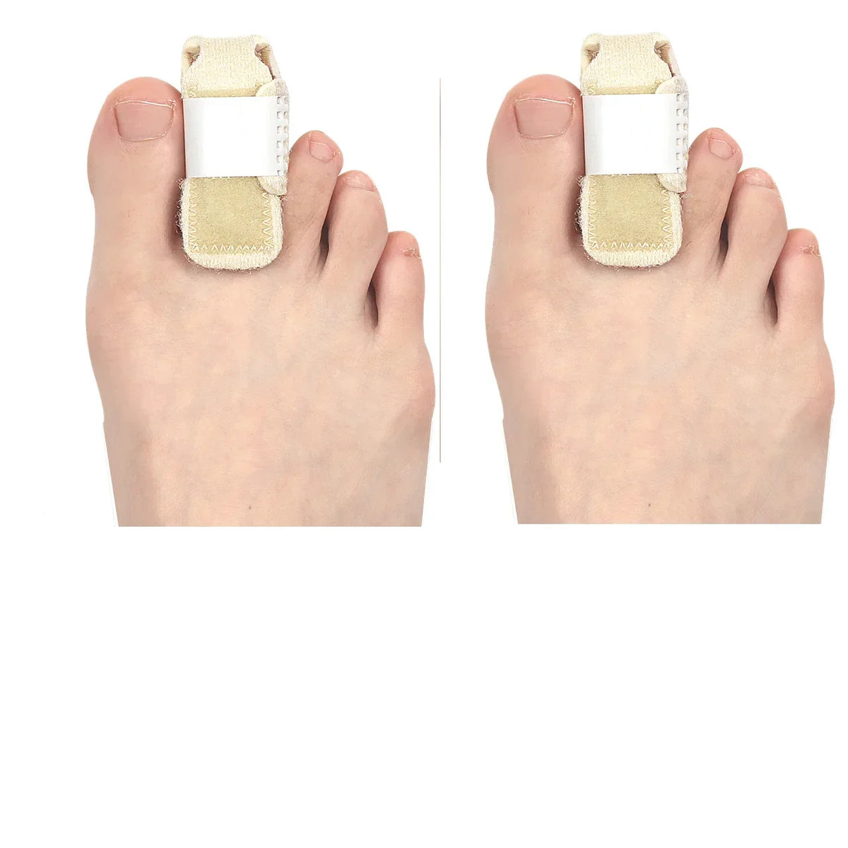 Toe Corrector Hammer Toe Splint Wrap